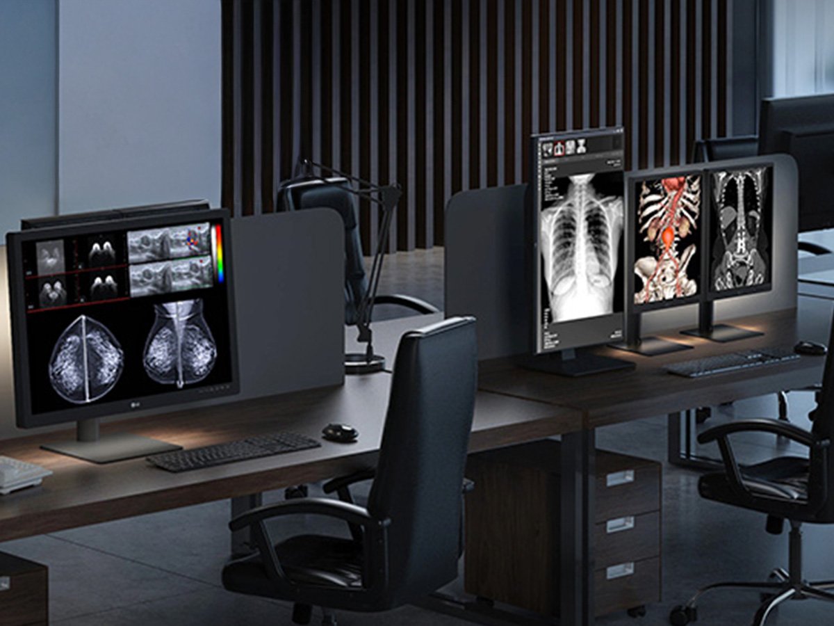 Modern office with multiple computer monitors displaying grayscale and color medical scans, including X-rays and MRIs, on a wooden desk.